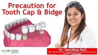 Precautions for Tooth Cap and Bridge || Dental Treatment || Dental Care - By HealthFirst All in 1