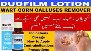 Duofilm lotion | wart remover | mohkay kese khatam krein | warts calluses corn remover medicine