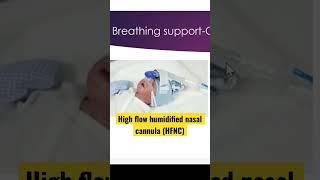 Baby on high flow humidified nasal cannula (HFNC) #nicu #neonatal #neonatology #ventilation #HFNC