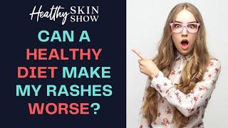 Can A Healthy Diet Change Make My Rashes WORSE?! | Jennifer Fugo