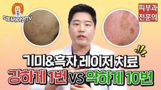 [기미정복 3탄] 얼굴 흑자 기미 제거 레이저치료_강하게1번 VS 약하게10회 비교분석, 저출력방식을 추천하는이유
