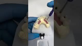 Top U.S. Dental Lab for advanced implant restorations & full-arch solutions! 