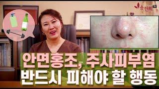 안면홍조, 주사피부염 환자라면 하지 말아야 할 행동?