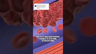 Has There Ever Been a Medical Emergency in Space?