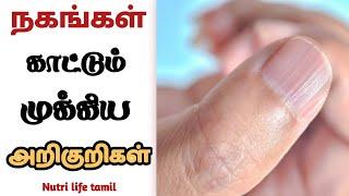 symptoms of nails colors in tamil/ நகத்தின் அடையாளங்கள் காட்டும் அறிகுறிகள்