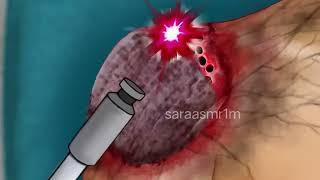 Asmr Relaxing treatment animation  Sara asmr 1m #short#asmr #asmrsleep #shorts
