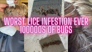 1+ Yr Lice Infestation l Worst Lice Infestation Ever  l 2 1/2 Hr Head Lice Treatment