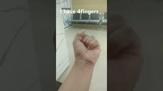 I have 4 fingers #short @maahidhamipahadi8493