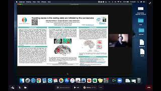 Traveling waves in the resting state are initiated by the connectome