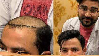 Hair Unit Patch Hair Grooming tutorial by Qadri salon....2023