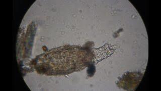 Rotifer from a pinch of moss in my garden