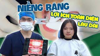 Tháo mắc cài niềng răng Hô, Khấp khểnh - Thay đổi nụ cười sau niềng răng