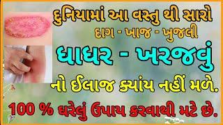 દાદર ધાધર ખરજવું માટે અક્સીર આયુર્વેદીક ઉપચાર | Ringworm Ayurveda Remedy | Hitesh Sheladiya