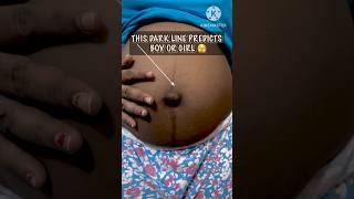 Pregnancy dark line on belly II Linea Nigra II #viral #shorts #youtubeshorts #pregnancy