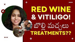 Red Wine & Vitiligo Treatments in Telugu | Dr. Deepthi | crowns clinic