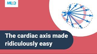 The cardiac axis made ridiculously easy