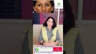 वांग/hyperpigmentation #skincare #doctor #ponds #garnier #skin #viral #trending #ytshorts #youtube