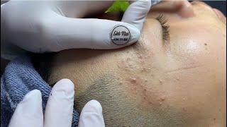 Priority preview content for registered members Spa Linh Mun #79