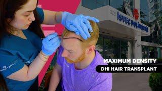 MAXIMUM GRAFT - DHI HAIR TRANSPLANT