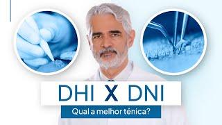 DHI e DNI: qual é a diferença? | Implante capilar