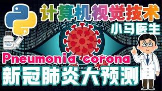 21.Python Computer Vision 计算机视觉技术 - 小马医生 - 新冠肺炎大预测 Pneumonia corona