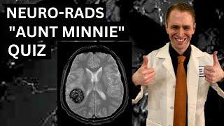 Neuroradiology "Aunt Minnie" Quiz