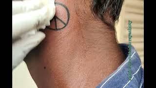 abhi tattoo Studio rayachoty #peace #necktattoo #tattooremoval #kadapa #tattooart #tattooartist