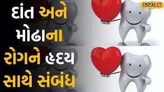 Health and lifestyle: દાંત અને મોઢાના રોગનો સીધો હૃદય સાથે સંબંધ, ચેતતા નર સદા સુખી