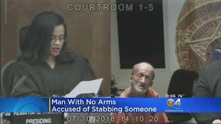 Miami Man Without Arms Charged With Using Scissors To Stab Tourist