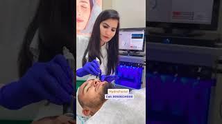 HydraFacial at Smileup Clinic #ytshorts #youtubeshorts #hydrafacialtreatment