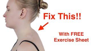 Easy Fix for the Neck Hump! (With FREE Exercise Sheet!)