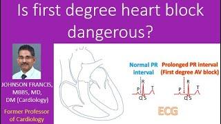 Is first degree heart block dangerous?