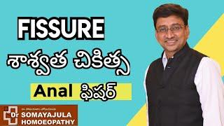 FISSURE Best Homeo Medicine / How to Reduce Fissure naturally Telugu / Dr Somayajula