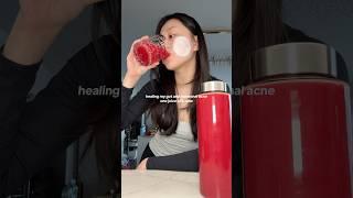 Healing my gut one juice at a time #skincare #acne #acneproneskin #clearskin