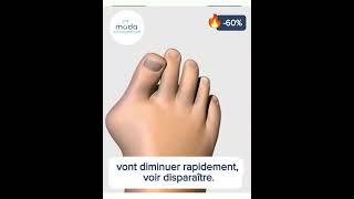 Moda Orthopédique : Chaussures Orthopédiques à Talons Compensés Été pour femme