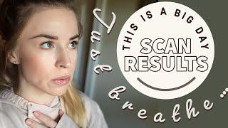 SCAN RESULTS!!! | Can I beat cancer without cancer treatment?? #stage4melanoma