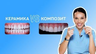 Какие виниры выбрать: керамические или композитные?