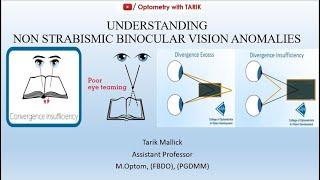 Understanding Non Strabismic Binocular Vision Anomalies