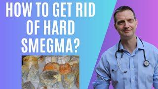 How to get rid of a build up of hard smegma, the easy way.