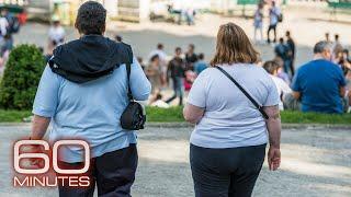 Recognizing and treating obesity as a disease | 60 Minutes