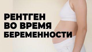 Рентген во Время Беременности. Рекомендации Врача.