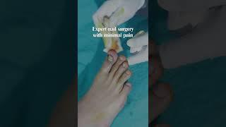 Nail Infection Surgery (Partial Nail Avulsion) | Advanced Treatment at Skinaa Clinic Jaipur #ytshort