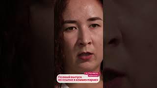 Варикозная болезнь на руке | Я стесняюсь своего тела