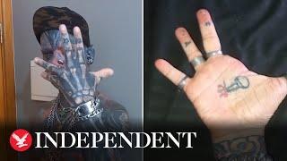 World's most modified man has fingers chopped off to look like 'devil'