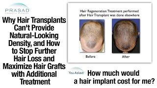 Why Hair Transplants Can't Replicate Natural Hair Density, and How to Stop Further Hair Loss