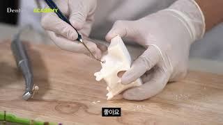 Implant Recipe 박주부의 수술비책 - DASK kit 상악동 거상술 전용 키트