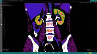 Athena DICOM Viewer Essential - Microsoft Store Trailer