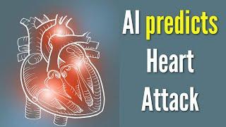 AI predicts if and when someone will experience cardiac arrest