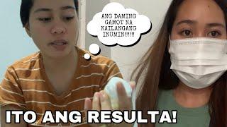 Biglaang check up! Hindi ako makapaniwla sa sinabi ng Doctor! ​⁠@edimeee9817