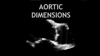 How to measure the AORTA: Echocardiogram!